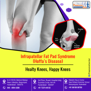 Infrapatellar Fat Pad Syndrome (or) Hoffa's Disease