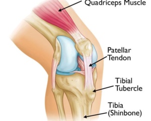 Osgood Schlatter (or) Tibial Tubercle