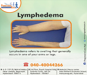 Lymphedema (or) Leymphoedema